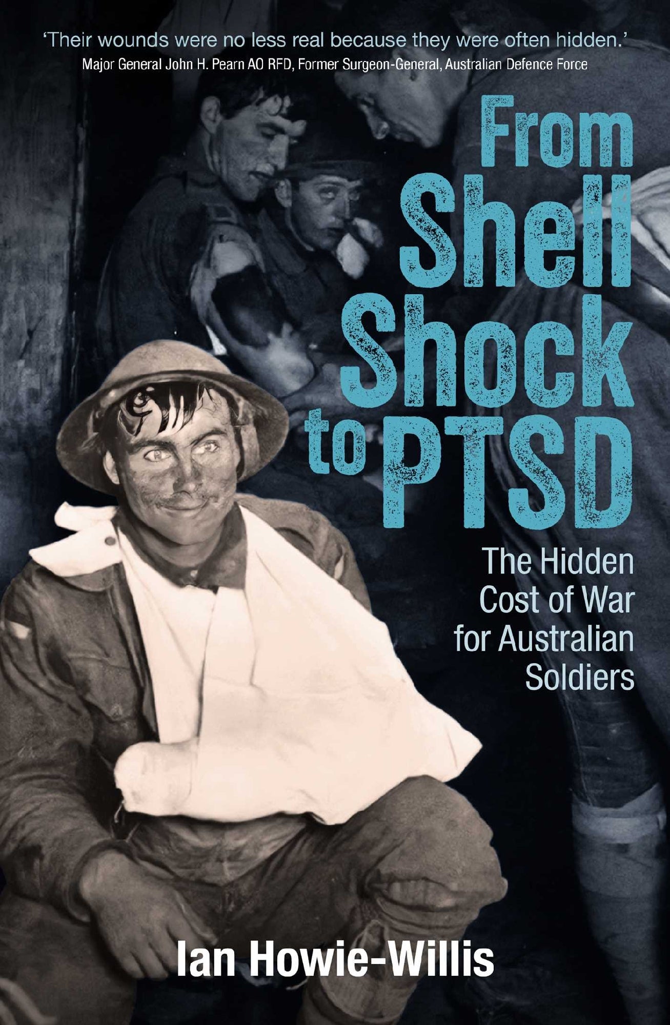 From Shell Shock To Ptsd